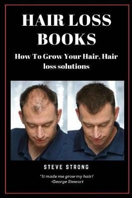 Book cover for Hair Loss Books