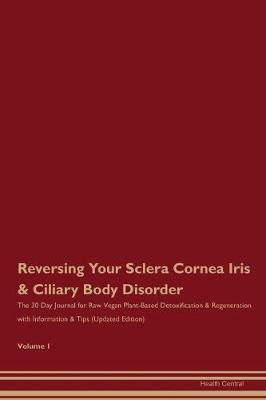 Book cover for Reversing Your Sclera, Cornea, Iris & Ciliary Body Disorder