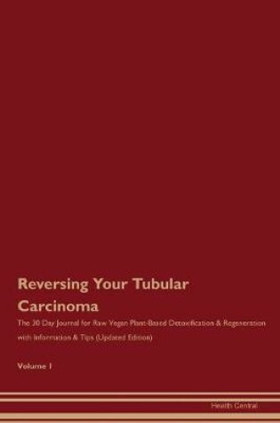 Cover of Reversing Your Tubular Carcinoma