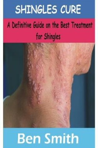 Cover of Shingles Cure
