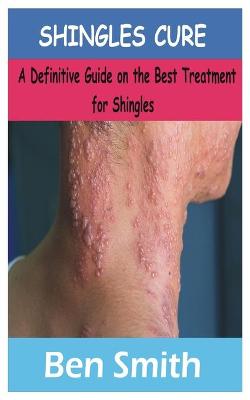 Book cover for Shingles Cure