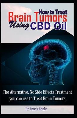 Book cover for How to Treat Brain Tumors Using CBD Oil