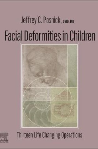 Cover of Facial Deformities in Children - E-Book