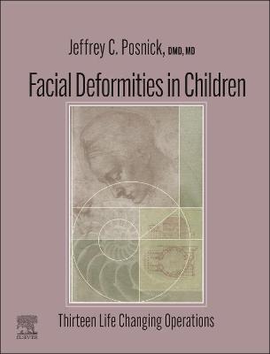 Book cover for Facial Deformities in Children - E-Book