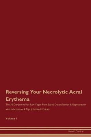 Cover of Reversing Your Necrolytic Acral Erythema