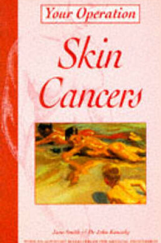 Cover of Skin Cancers