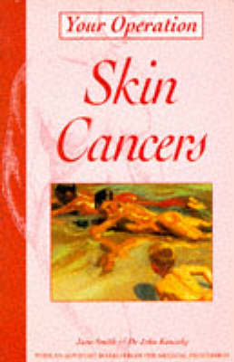 Book cover for Skin Cancers