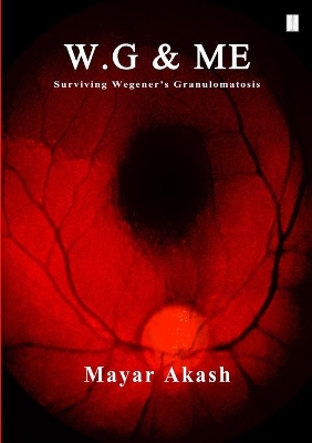 Book cover for W.G & ME, Surviving Wegener's Granulomatosis