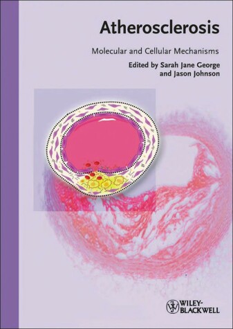 Book cover for Atherosclerosis – Molecular and Cellular Mechanisms