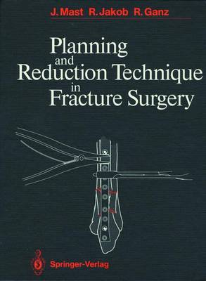 Cover of Planning and Reduction Technique in Fracture Surgery