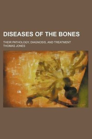 Cover of Diseases of the Bones; Their Pathology, Diagnosis, and Treatment