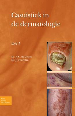 Cover of Casuïstiek in de dermatologie - deel I