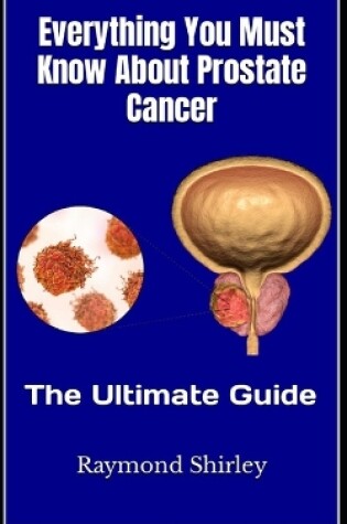 Cover of Everything You Must Know About Prostate Cancer