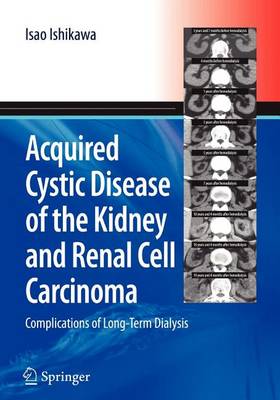 Book cover for Acquired Cystic Disease of the Kidney and Renal Cell Carcinoma