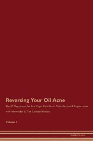 Cover of Reversing Your Oil Acne