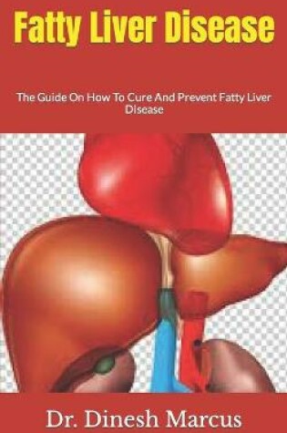 Cover of Fatty Liver Disease