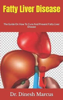 Cover of Fatty Liver Disease