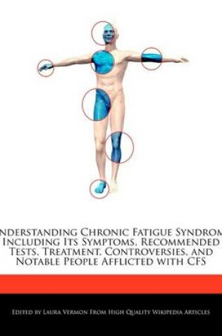 Cover of Understanding Chronic Fatigue Syndrome Including Its Symptoms, Recommended Tests, Treatment, Controversies, and Notable People Afflicted with Cfs