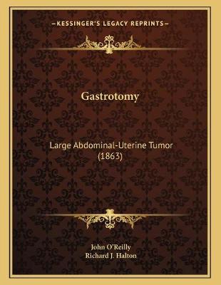 Book cover for Gastrotomy
