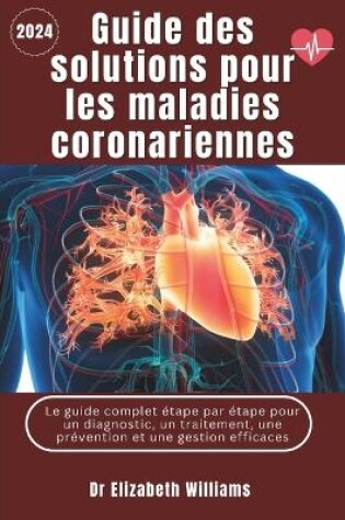 Cover of Guide de solutions pour les maladies coronariennes