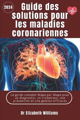 Book cover for Guide de solutions pour les maladies coronariennes