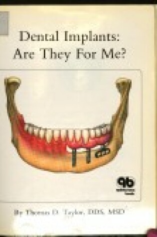 Cover of Dental Implants