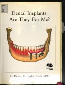 Book cover for Dental Implants