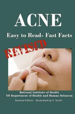 Book cover for Acne