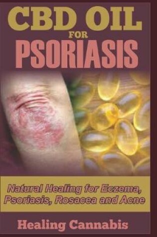 Cover of CBD Oil for Psoriasis