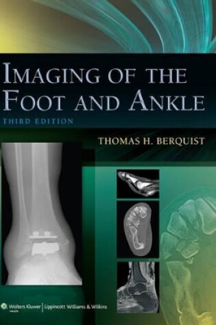 Cover of Imaging of the Foot and Ankle