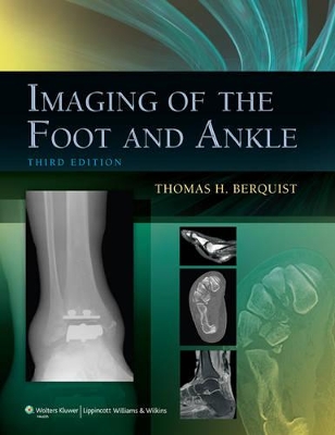 Book cover for Imaging of the Foot and Ankle