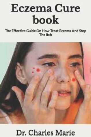 Cover of Eczema Cure book