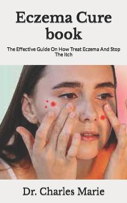 Cover of Eczema Cure book