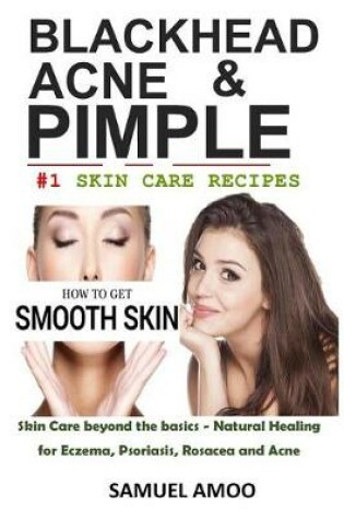 Cover of Blackheads, Acne & Pimple