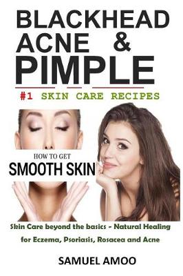 Book cover for Blackheads, Acne & Pimple