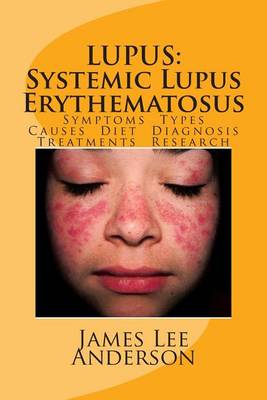 Book cover for Lupus