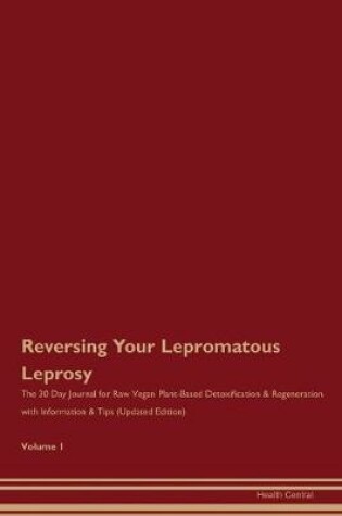 Cover of Reversing Your Lepromatous Leprosy