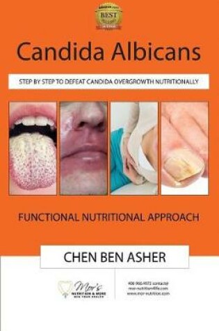 Cover of Candida Albicans