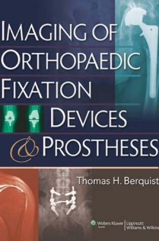 Cover of Imaging of Orthopaedic Fixation Devices and Prostheses