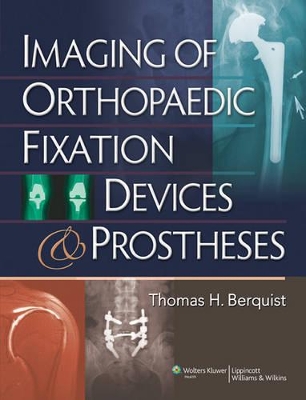 Book cover for Imaging of Orthopaedic Fixation Devices and Prostheses