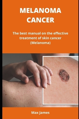 Book cover for Melanoma Cancer