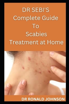 Book cover for Dr Sebi's Complete Guide to Scabies Treatment at Home