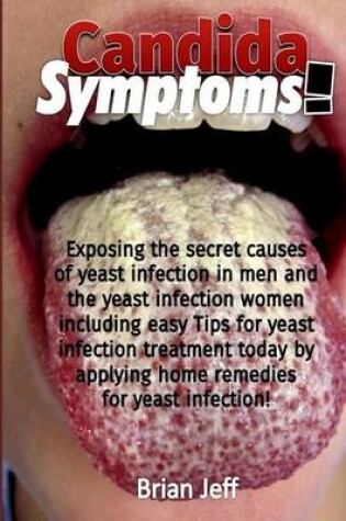 Cover of Candida Symptoms!
