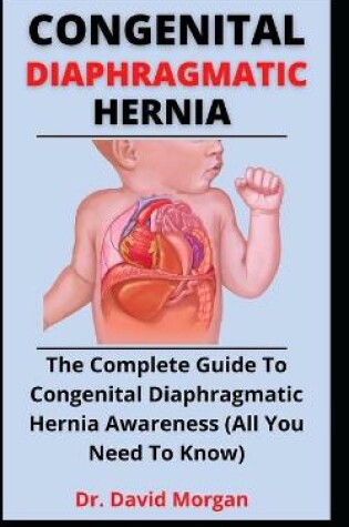 Cover of Congenital Diaphragmatic Hernia