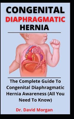 Book cover for Congenital Diaphragmatic Hernia