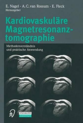 Book cover for Kardiovaskulare Magnetresonanztomographie