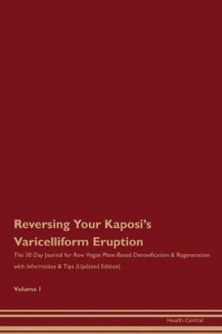 Cover of Reversing Your Kaposi's Varicelliform Eruption