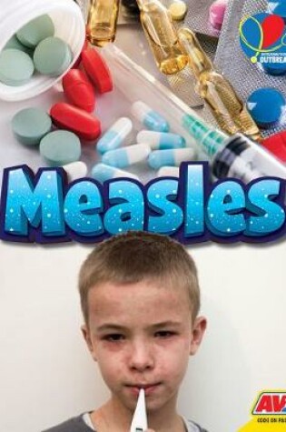 Cover of Measles