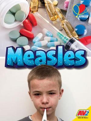 Book cover for Measles