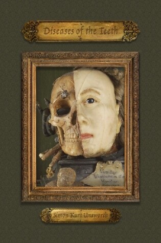 Cover of Diseases of the Teeth
